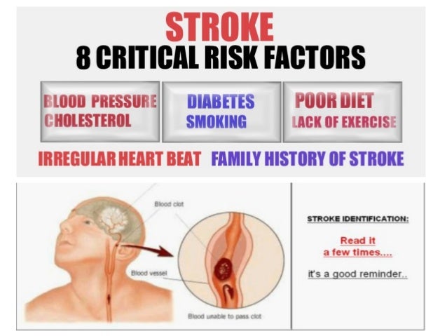 stroke symptoms related keywords suggestions for stroke symptoms stroke symptoms related keywords suggestions for stroke symptoms